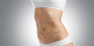 Usuwanie blizn i rozstępów – czy da się do zrobić w domu?