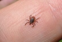 Ile żyją wszy na głowie?