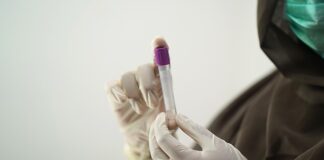 Ile kosztuje badanie PSA prywatnie? Ile kosztuje badanie PSA prywatnie?