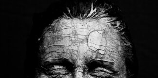 Jak wygląda sucha gnida? Jak wygląda sucha gnida?