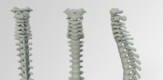 Czy nimesil jest dobry na ból kręgosłupa?